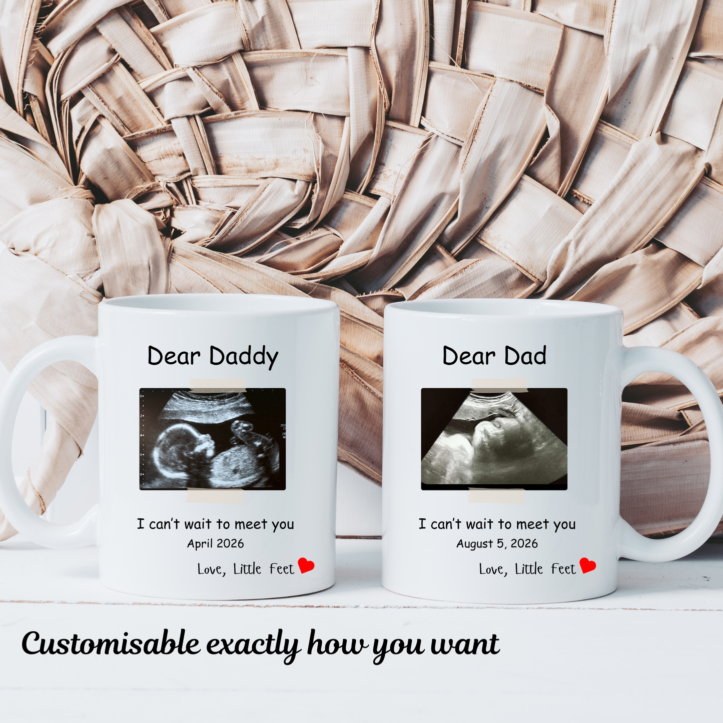 Dad Baby Reveal Mug. Ultrasound photo Mug. Baby Reveal Mug for Dad. Dad Baby Reveal Mug with Ultrasound photo