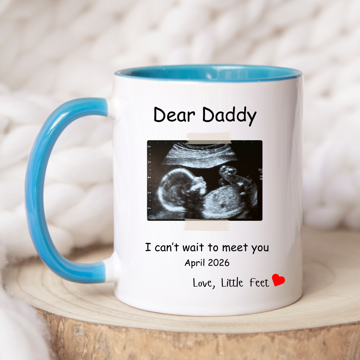Dad Baby Reveal Mug. Ultrasound photo Mug. Baby Reveal Mug for Dad. Dad Baby Reveal Mug with Ultrasound photo